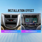 for Hyundai Accent 2012-2017 Dual Display Knobs CarPlay/Android Auto Autoradio FM Radio Navigation Stereo Pad Player GPS 10.1" QLED Touch Screen Headunit Tablet Quad Core 2G+64G Black